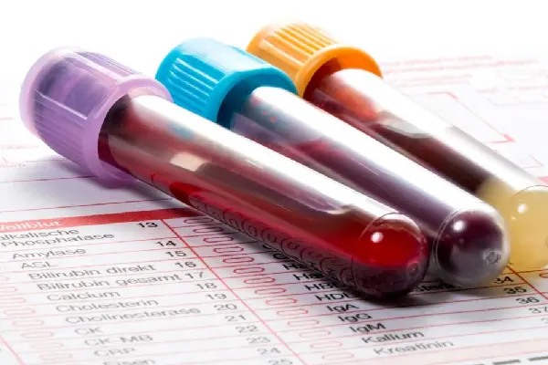 servicesglycodepot-3